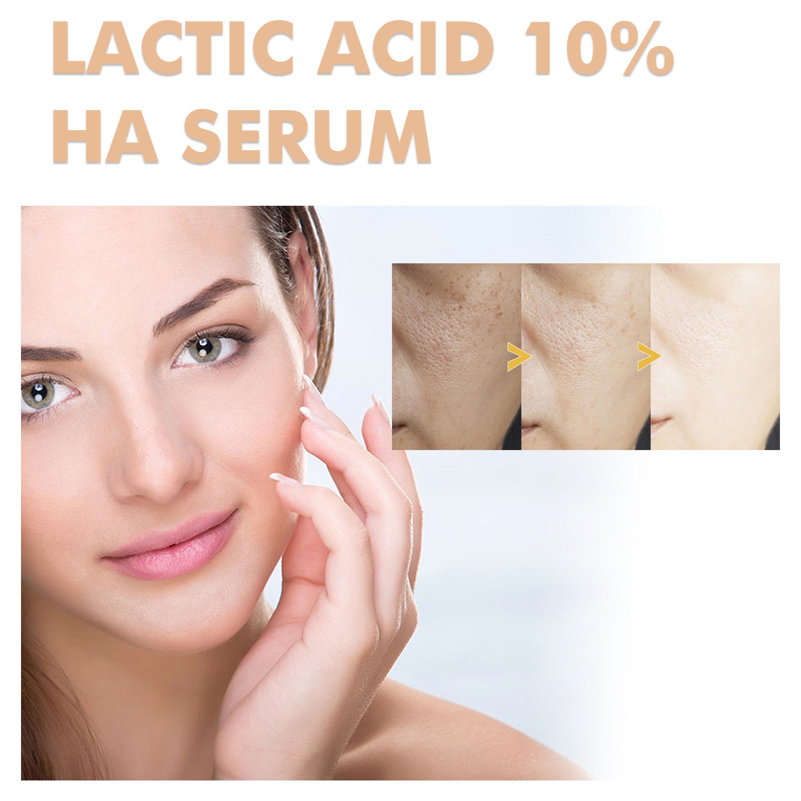 Hoygi Lactic Acid Facial Essence Desalting PIMPLE Acne Anti-wrinkle Nourishing And Hydrating