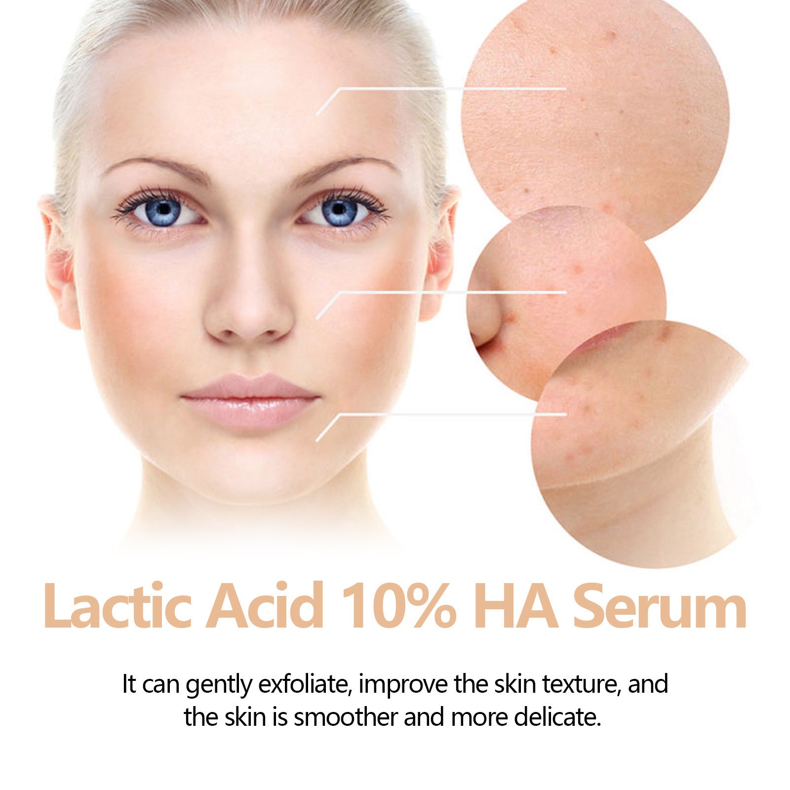 Hoygi Lactic Acid Facial Essence Desalting PIMPLE Acne Anti-wrinkle Nourishing And Hydrating